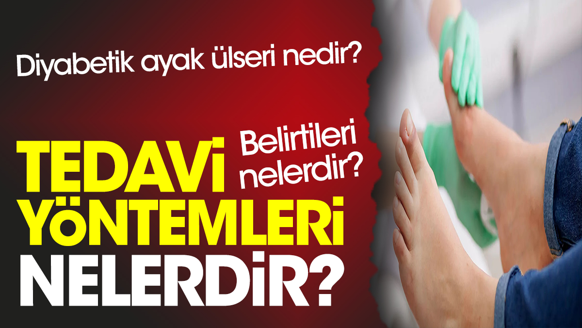 Diyabetik Ayak Lseri Nedir Belirtileri Nelerdir Tedavi Y Ntemleri