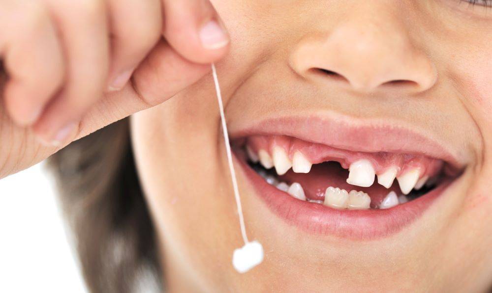 Çocuklarınızın süt dişlerini sakın atmayın. Hayati önem taşıyor 12