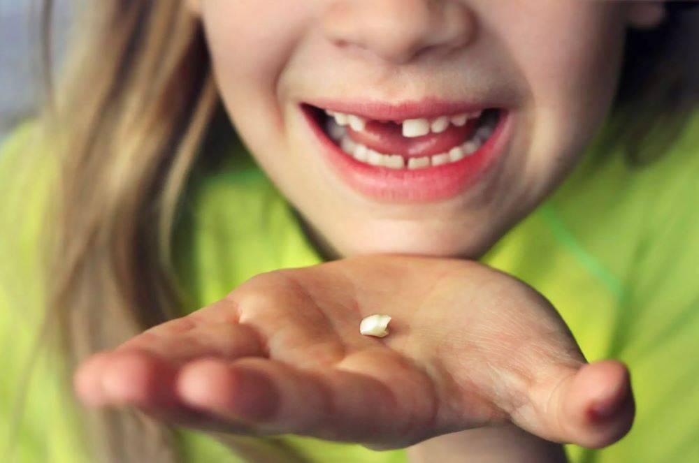 Çocuklarınızın süt dişlerini sakın atmayın. Hayati önem taşıyor 8