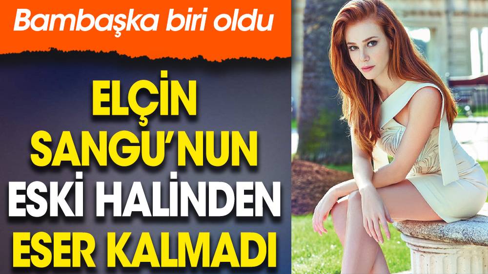 Elçin Sangu'nun eski halinden eser kalmadı. Bambaşka biri oldu 1