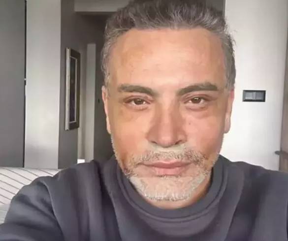 Türkiye'nin George Clooney'si Cenk Eren yüz gerdirme ameliyatı sonrası yeni halini paylaştı. Takipçileri 'Bu kim' diye sordu 4