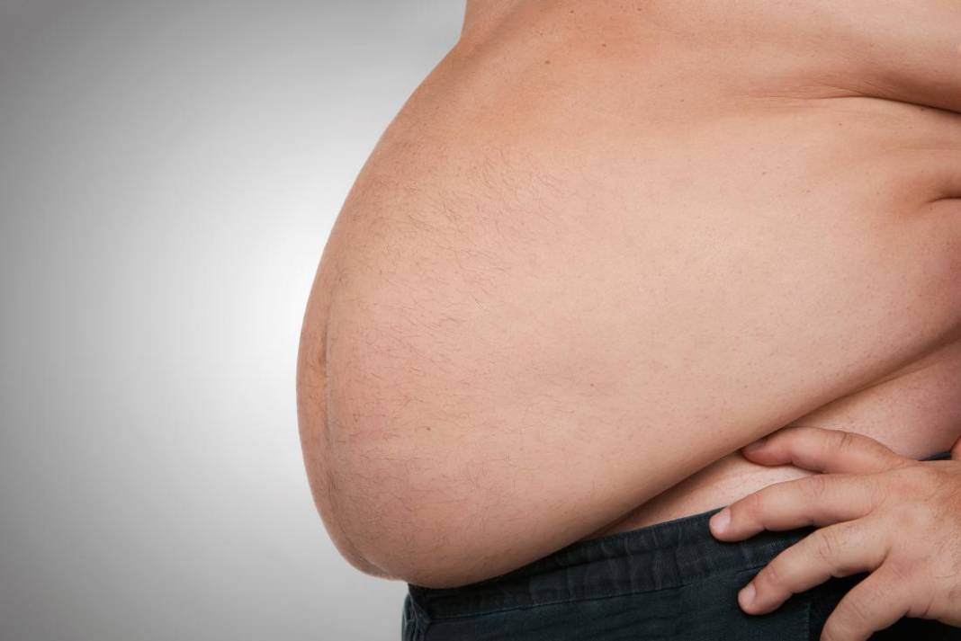 Obezite cerrahisi sonrası yaşam tarzı nasıl olmalı? 3