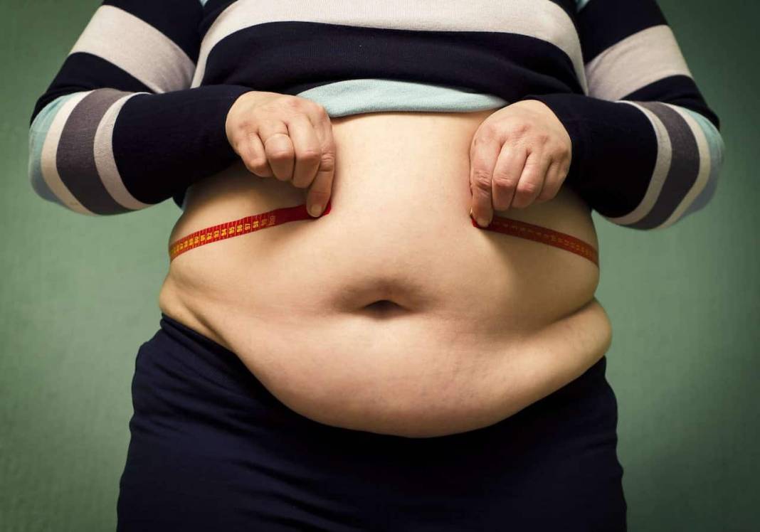 Obezite cerrahisi sonrası yaşam tarzı nasıl olmalı? 8