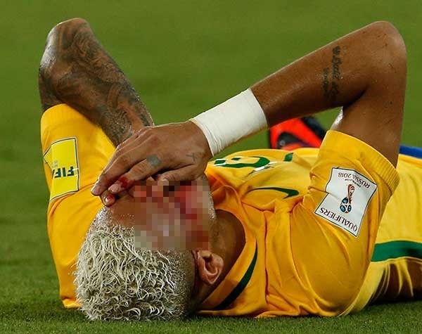 Neymar maçta kanlar içinde kaldı 2