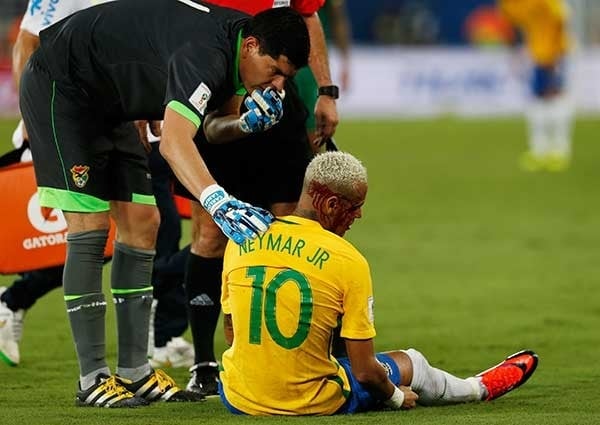 Neymar maçta kanlar içinde kaldı 7