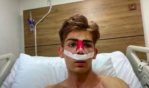 TikTok fenomeni Taha Duymaz, olağanüstü değişimiyle ağızları açık bıraktı 4