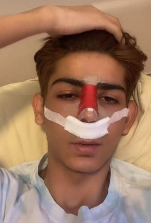 TikTok fenomeni Taha Duymaz, olağanüstü değişimiyle ağızları açık bıraktı 3