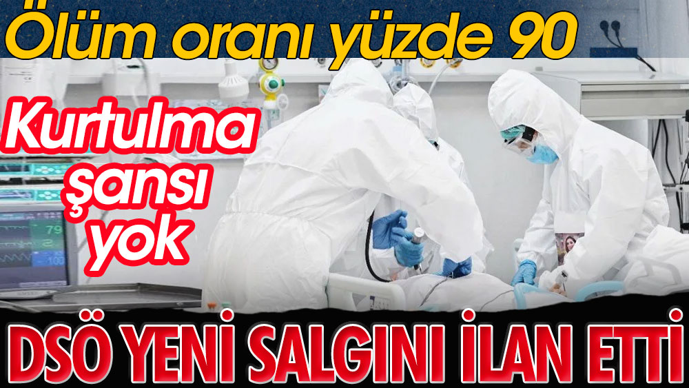 Ölüm oranı yüzde 90 tedavisi yok | Şimdi de bu çıktı: Marburg humması kabusu | DSÖ yeni salgını ilan etti 1