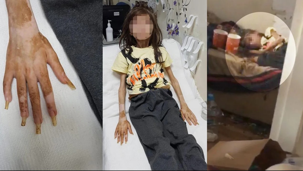 Çöp evde bulunan 9 yaşındaki Cem Muhammet'le ilgili flaş açıklama 13