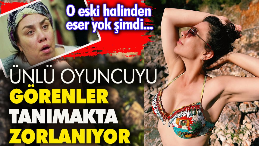 Ünlü oyuncuyu görenler tanımakta güçlük çekiyor O eski halinden eser yok şimdi 1