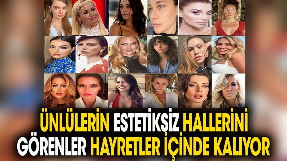 Ünlülerin estetiksiz hallerini tanıyamayacaksınız. Görenler hayretler içinde kalıyor 1