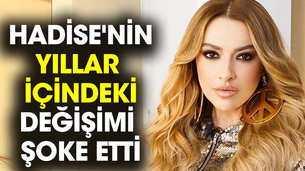 Hadise'nin yıllar içindeki değişimi şoke etti 1