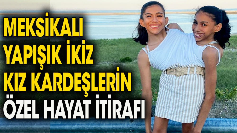 Yapışık kız kardeşler özel hayatlarını itiraf ettiler. Her soruyu açıkça cevapladılar 1