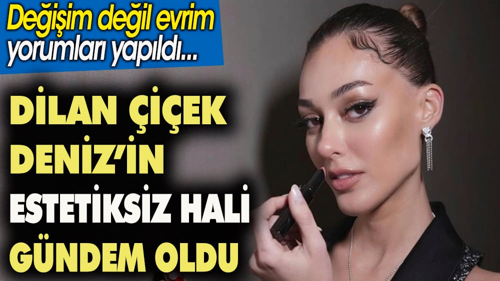 Dilan Çiçek Deniz'in estetiksiz hali gündem oldu. 'Değişim değil evrim' yorumları yapıldı 1