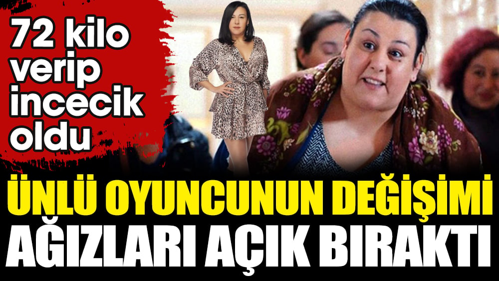 Oyuncu Esin Gündoğdu’nun değişimi ağızları açık bıraktı. 72 kilo verip incecik oldu 1