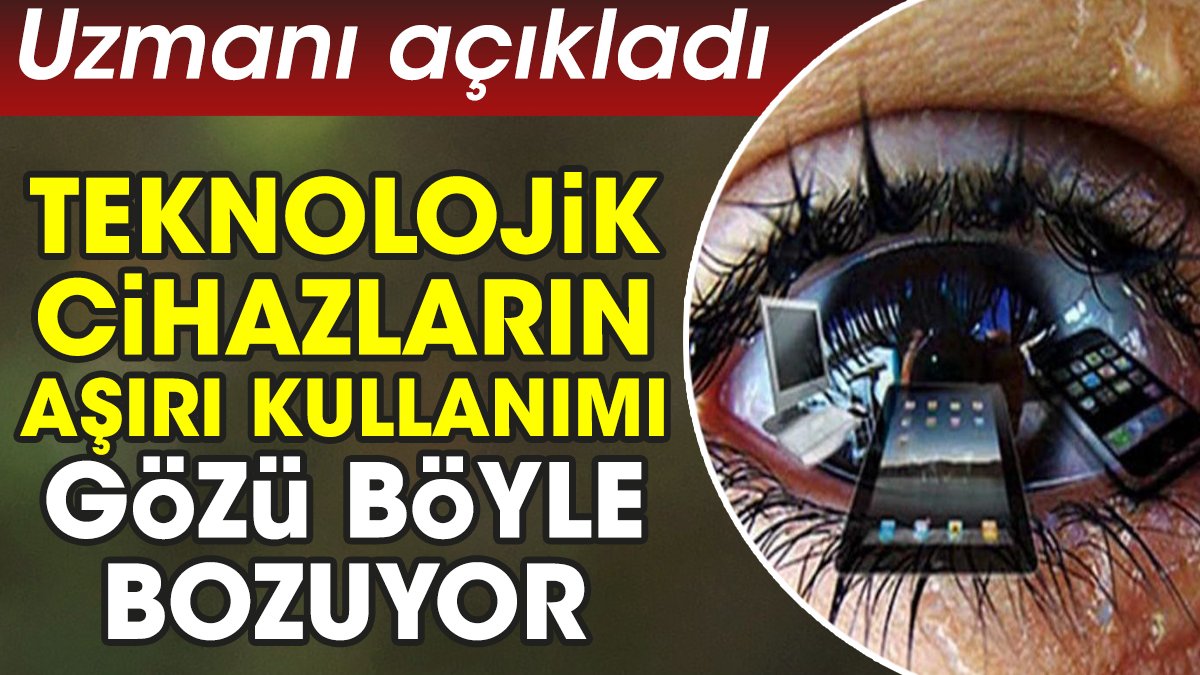 Teknolojik cihazların aşırı kullanımı gözü böyle bozuyor. Uzmanı açıkladı