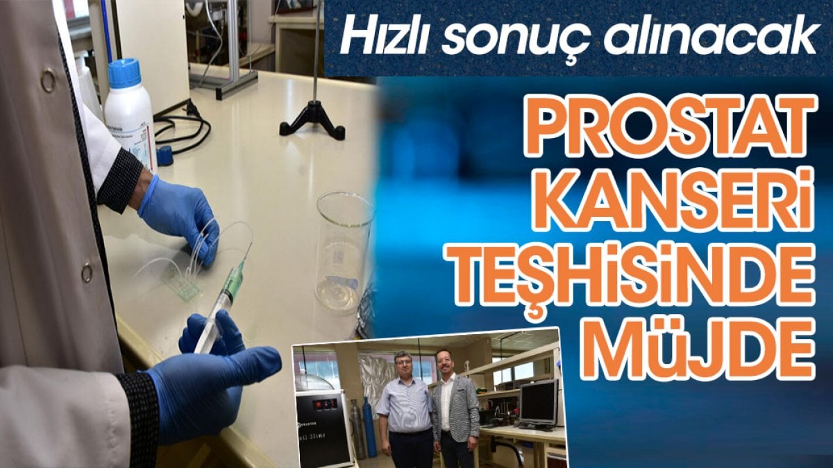 Prostat kanseri teşhisinde müjde. Hızlı sonuç alınacak