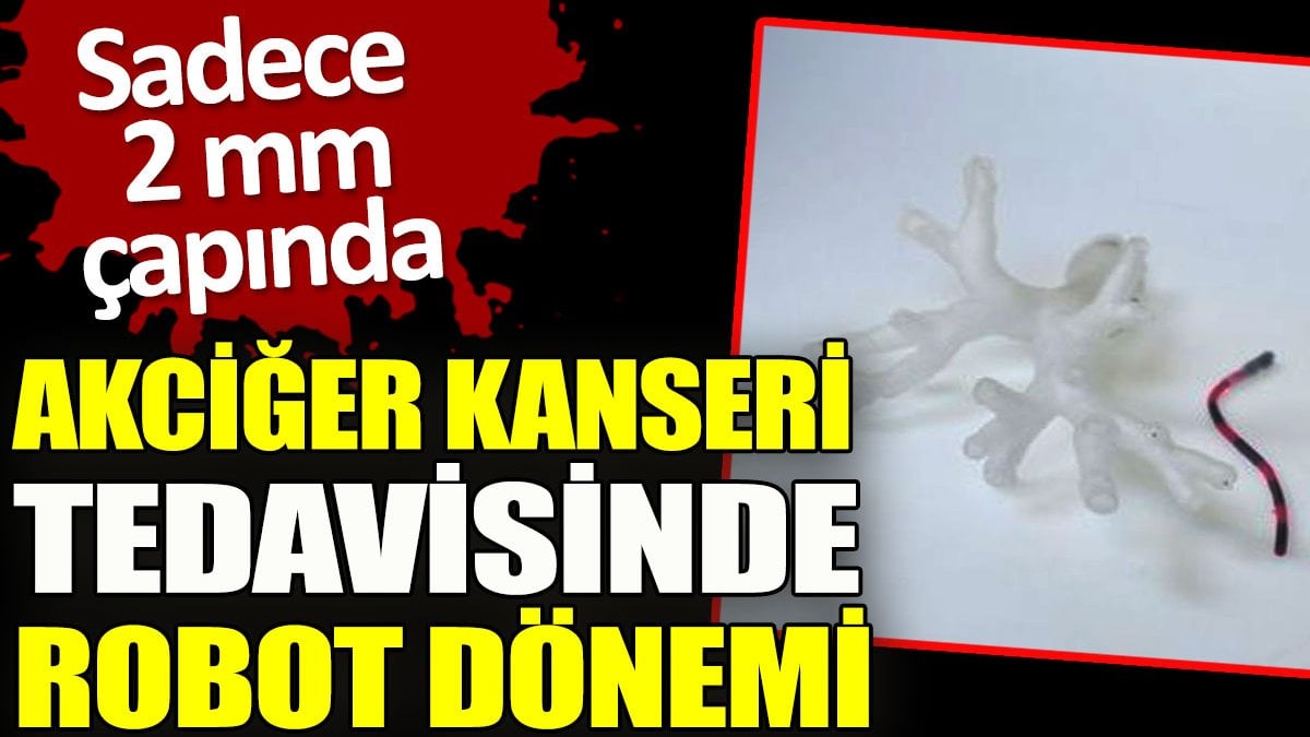 Akciğer kanseri tedavisinde robot dönemi