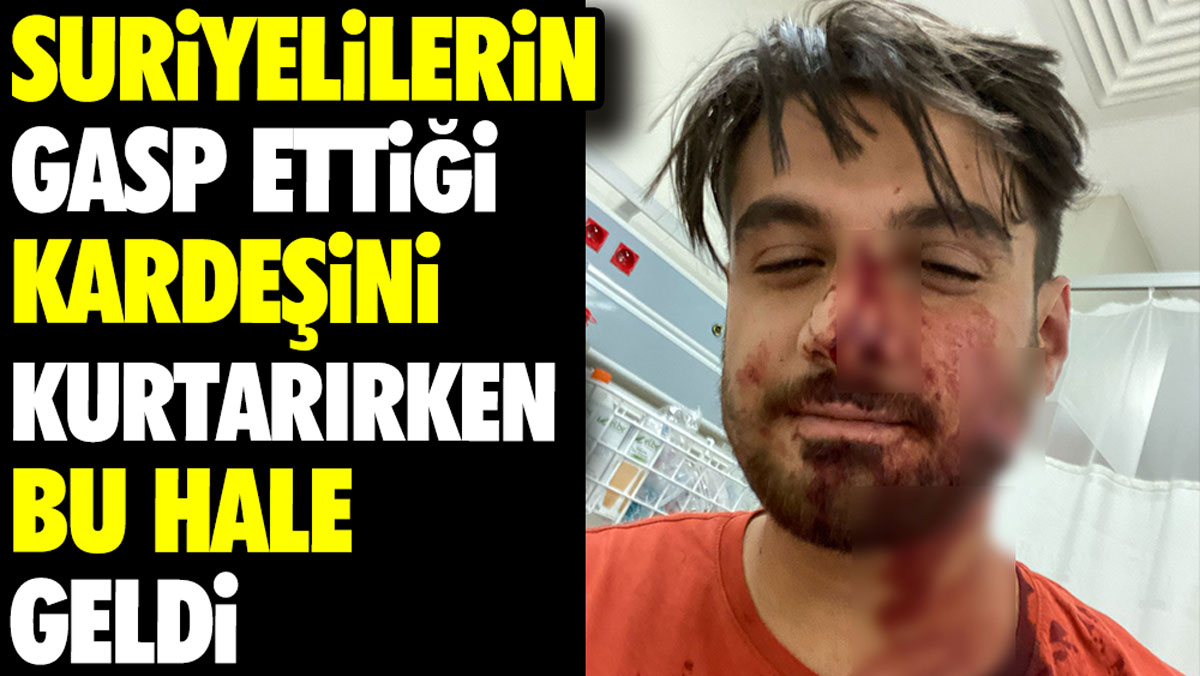 Suriyelilerin gasp ettiği kardeşini kurtarırken bu hale geldi