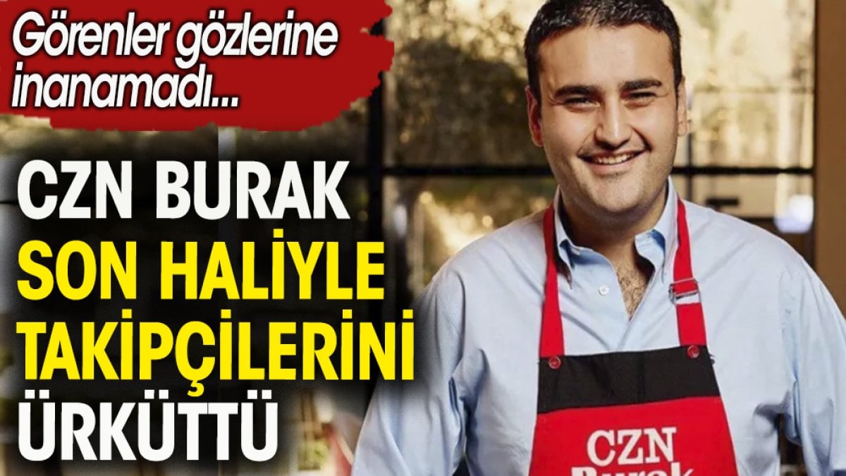 CZN Burak Özdemir takipçilerini ürküttü. Görenler gözlerine inanamadı