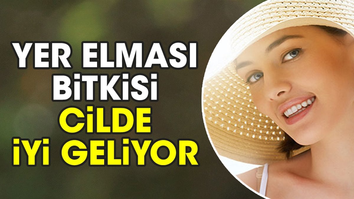 Cilde iyi gelen mucize bitkisinin faydaları dikkat çekti