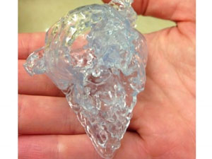 3D yazıcı, bebeğin hayatını kurtardı