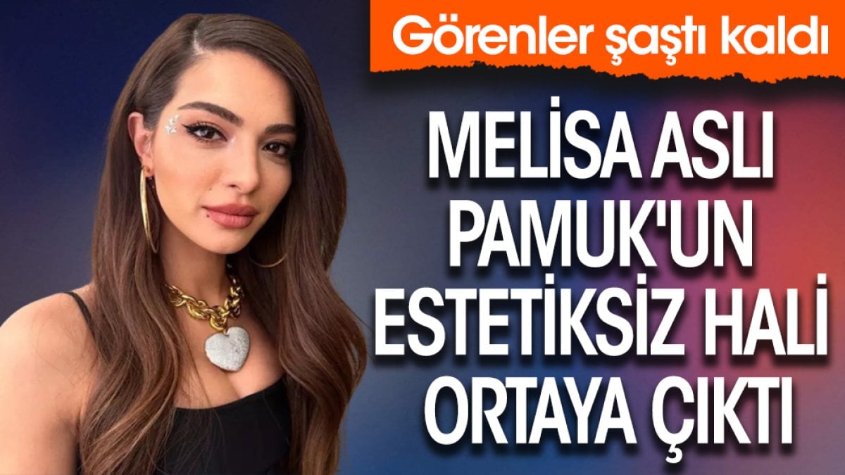 Melisa Aslı Pamuk'un estetiksiz hali ortaya çıktı! Görenler şaştı kaldı