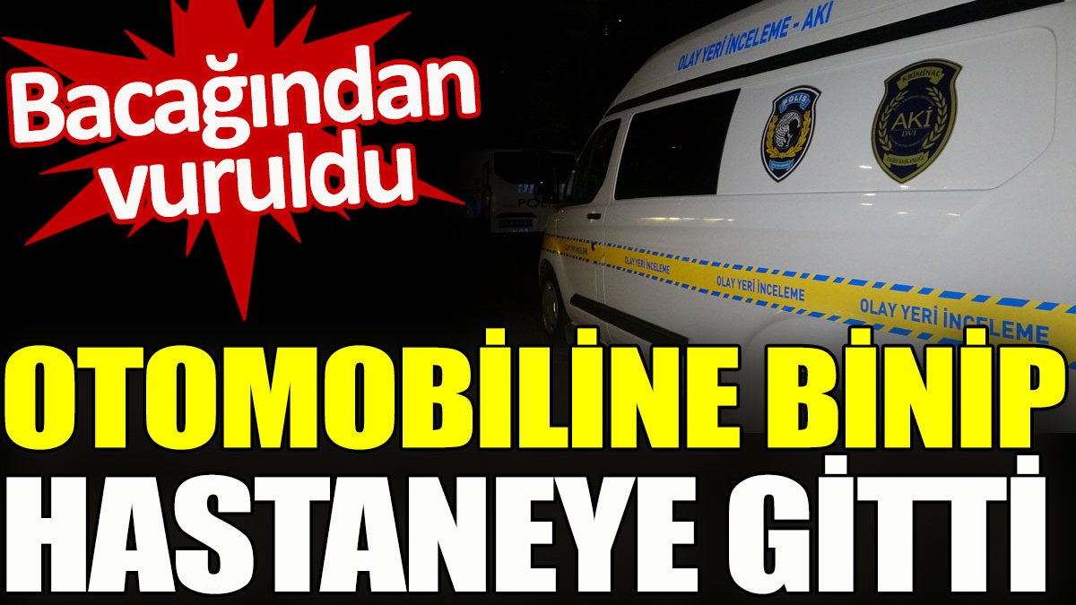 Bacağından vuruldu, otomobiline binip hastaneye gitti