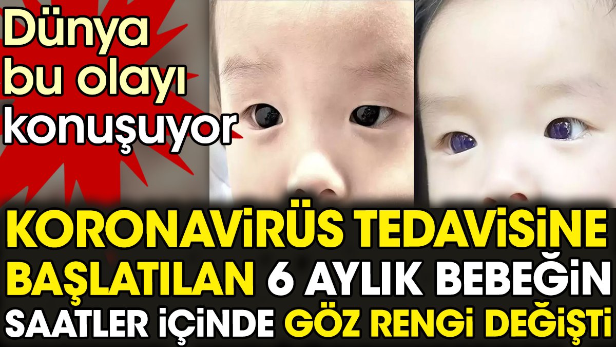 Koronavirüs tedavisine başlatılan 6 aylık bebeğin saatler içinde göz rengi değişti