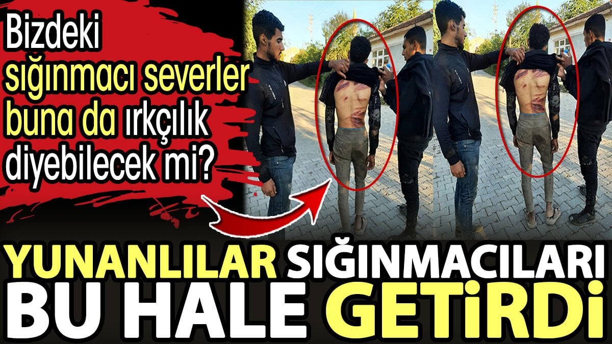 Yunanlılar sığınmacıları bu hale getirdi. Bizdeki sığınmacı severler buna da ırkçılık diyebilecek mi?