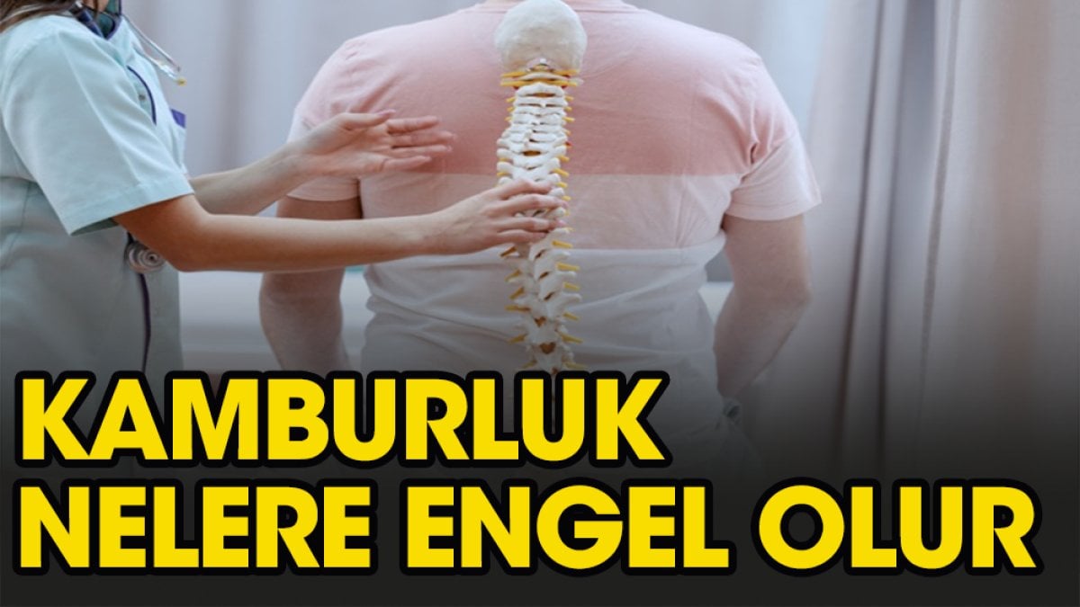 Kamburluk nelere engel olur?