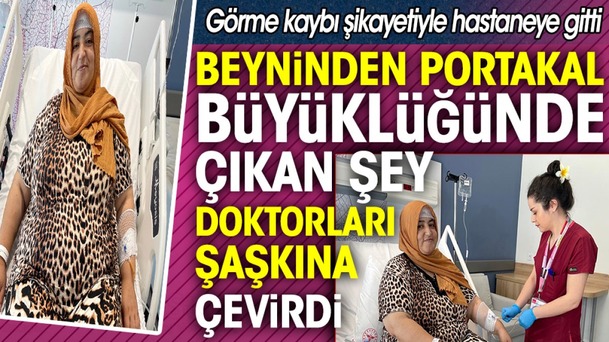 Beyninden portakal büyüklüğünde çıkan şey doktorları şaşkına çevirdi. Görme kaybı şikayetiyle hastaneye gitti