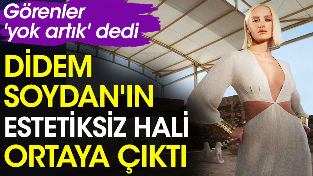 Didem Soydan'ın estetiksiz hali ortaya çıktı. Görenler 'yok artık' dedi