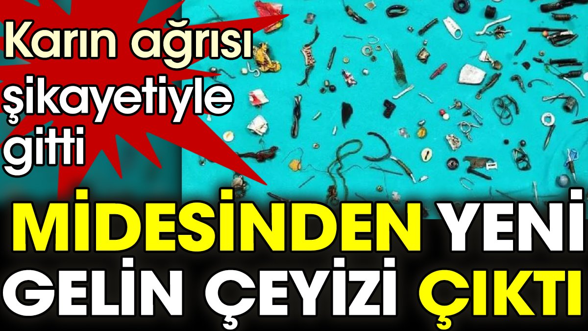 Karın ağrısı şikayetiyle gitti. Midesinden yeni gelin çeyizi çıktı