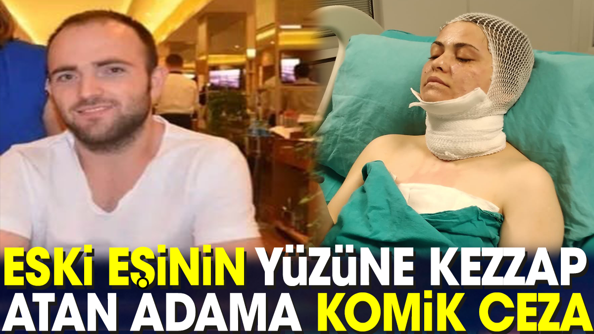 Eski eşinin yüzüne kezzap atan adama komik ceza