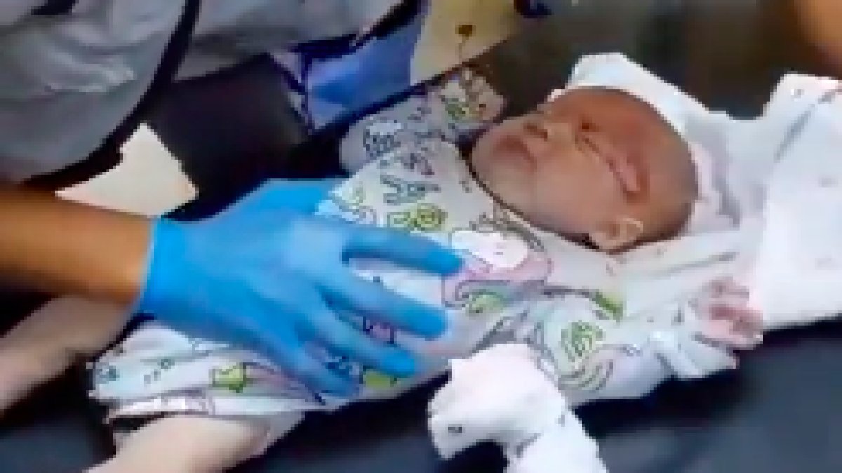 İsrail bombardımanında yaralanan küçük bebek...