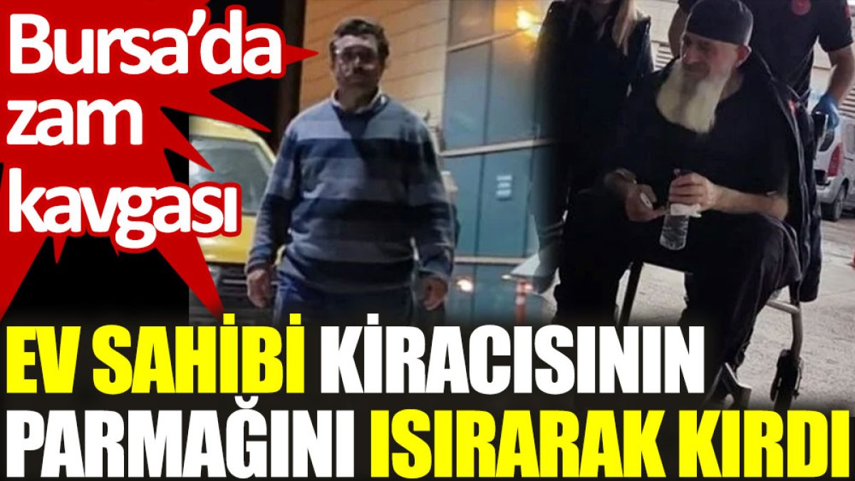 Bursa’da zam kavgası: Ev sahibi kiracısının parmağını ısırarak kırdı