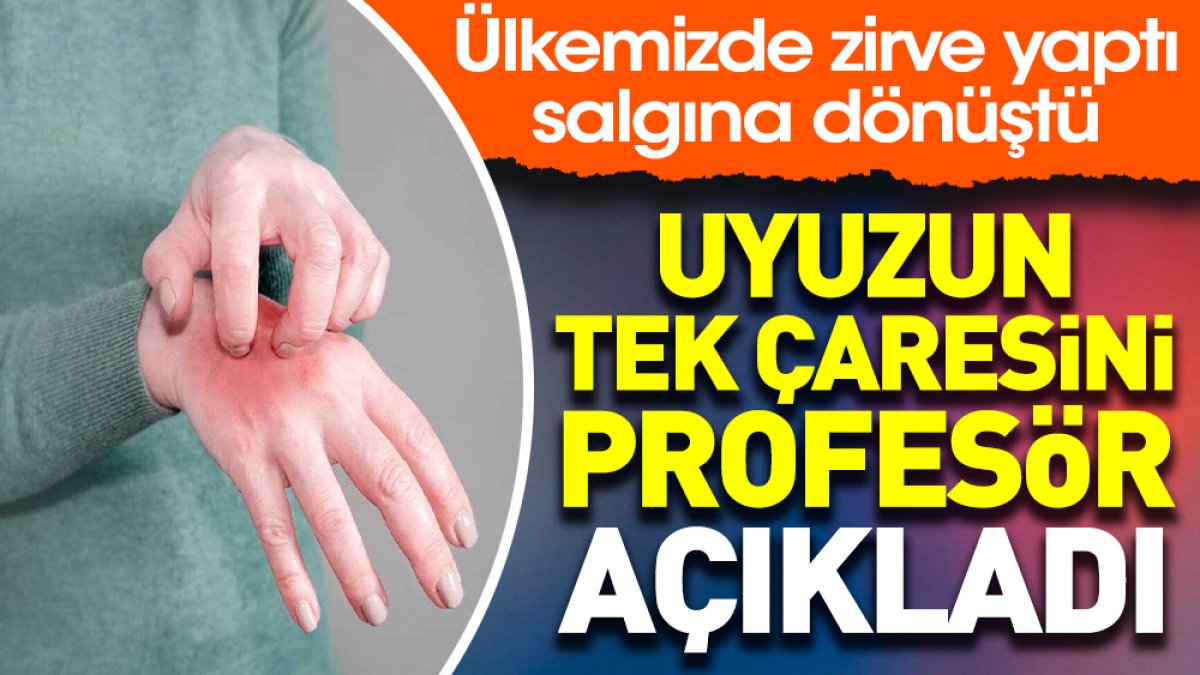 Uyuzun tek çaresini profesör açıkladı. Ülkemizde zirve yaptı salgına dönüştü