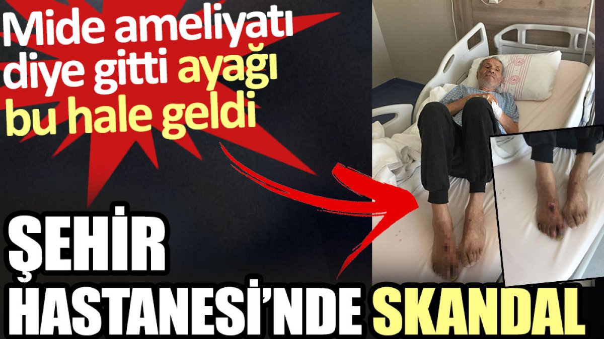 Şehir hastanesinde skandal. Mide ameliyatı diye gitti ayağı bu hale geldi