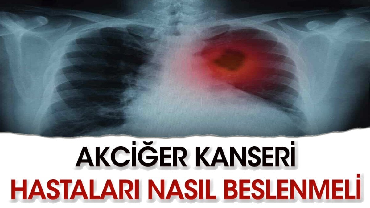 Akciğer kanseri hastalarına nasıl beslemeliyiz