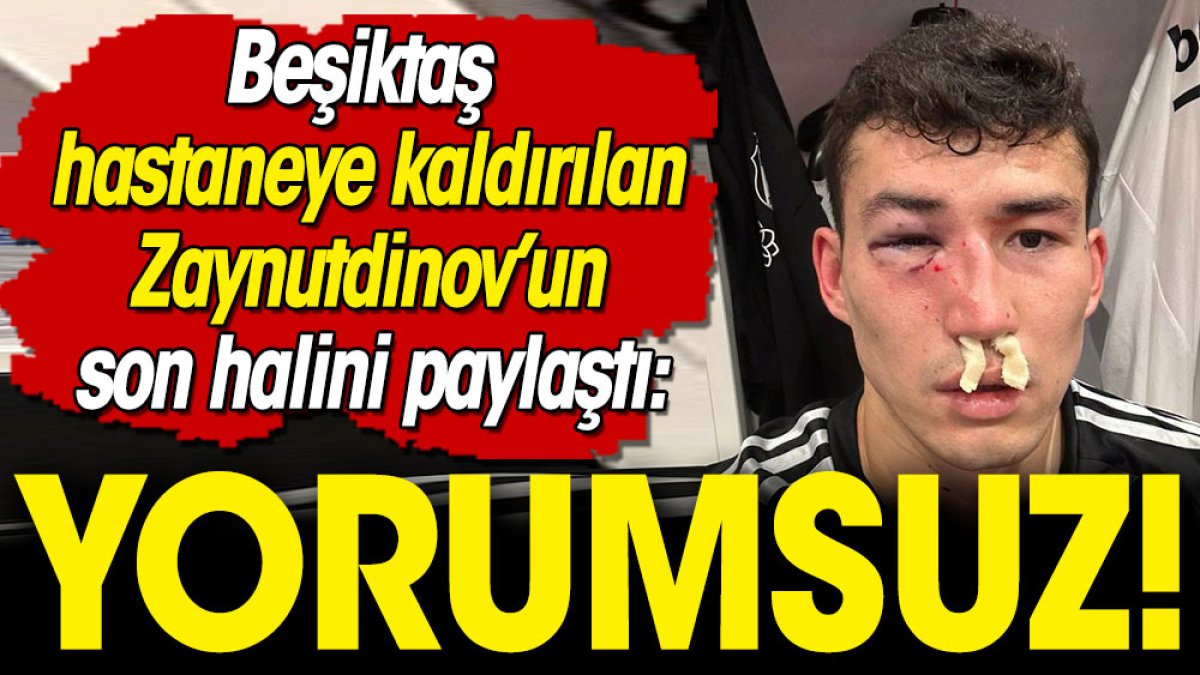 Beşiktaş Zaynutdinov'un son halini paylaştı: Yorumsuz!