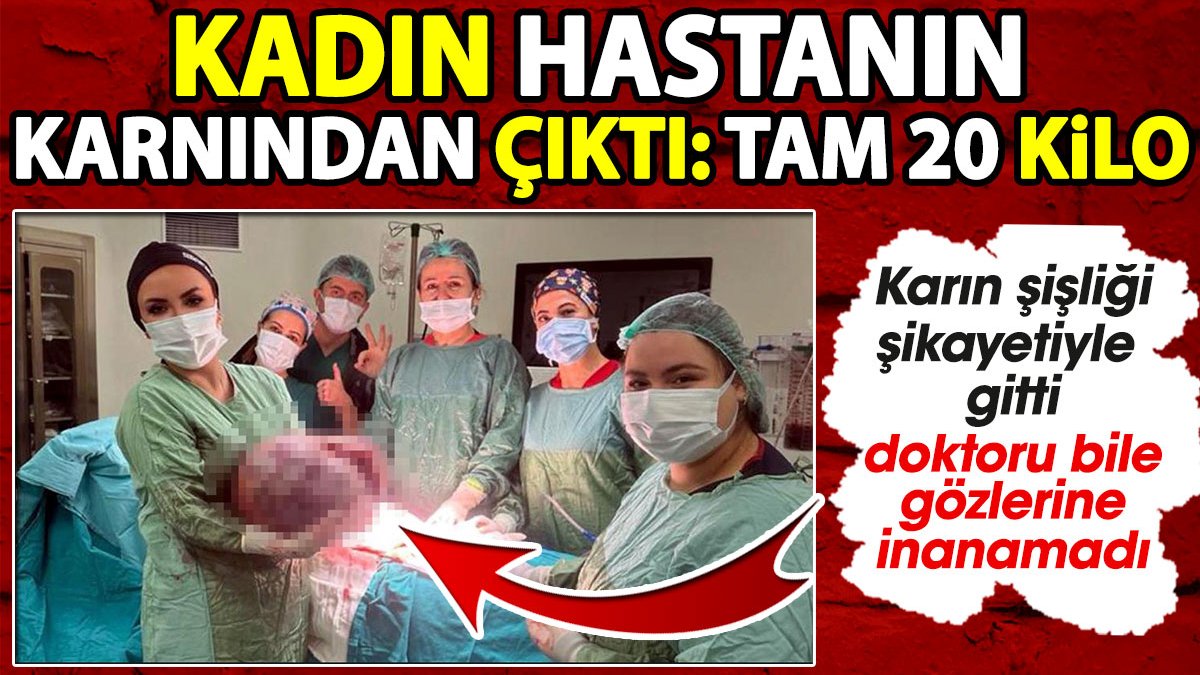 Kadın hastanın karnından çıktı: Tam 20 kilo! Doktoru bile gözlerine inanamadı