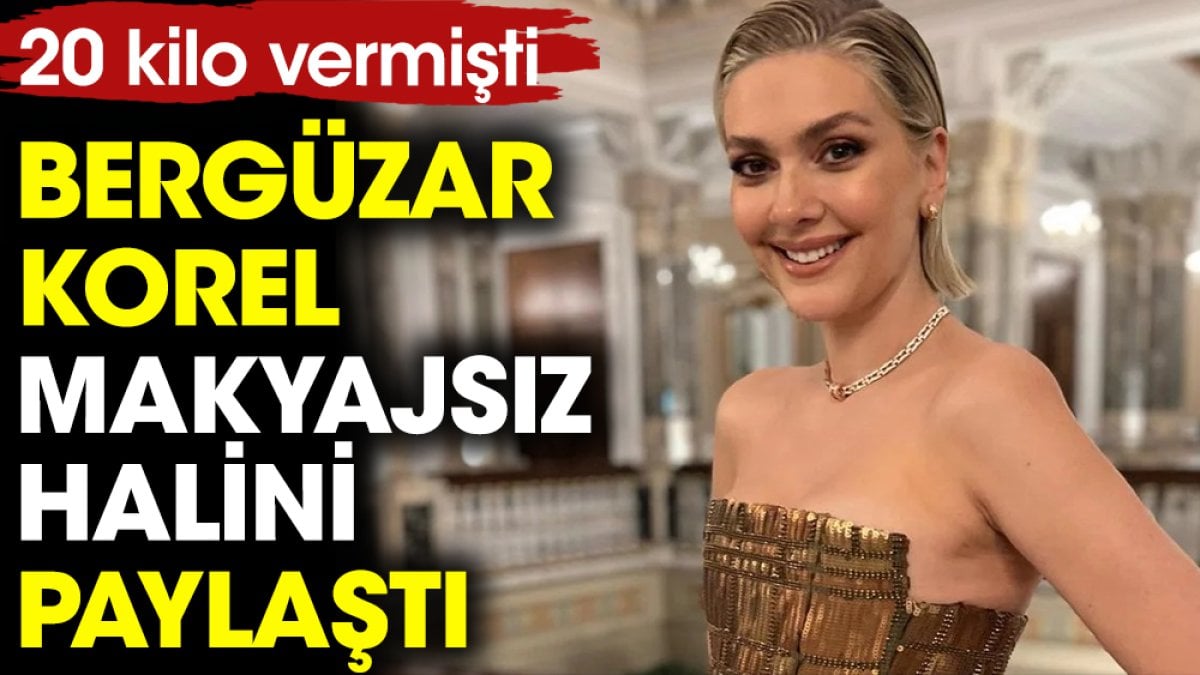 Bergüzar Korel makyajsız halini paylaştı. 20 kilo vermişti