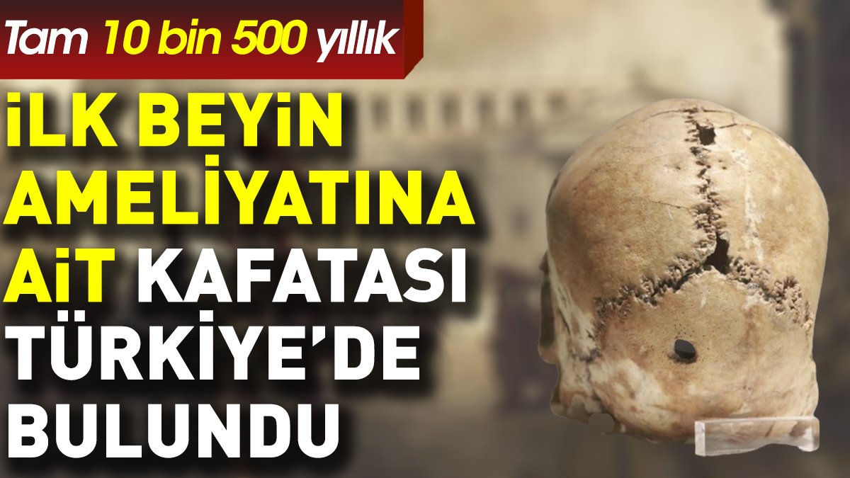 İlk beyin ameliyatına ait kafatası Türkiye'de bulundu. Tam 10 bin 500 yıllık
