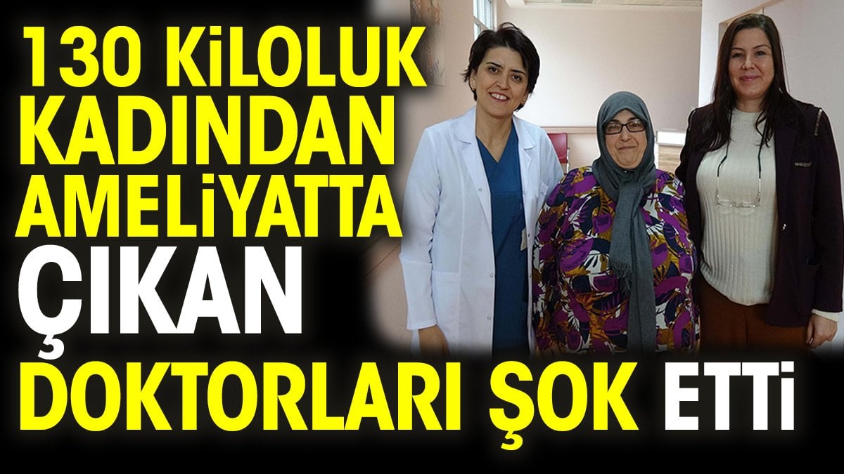 130 kiloluk kadından ameliyatta çıkan doktorları şok etti