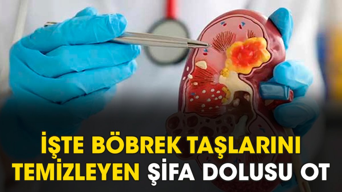 İşte böbrek taşlarını temizleyen şifa dolusu ot