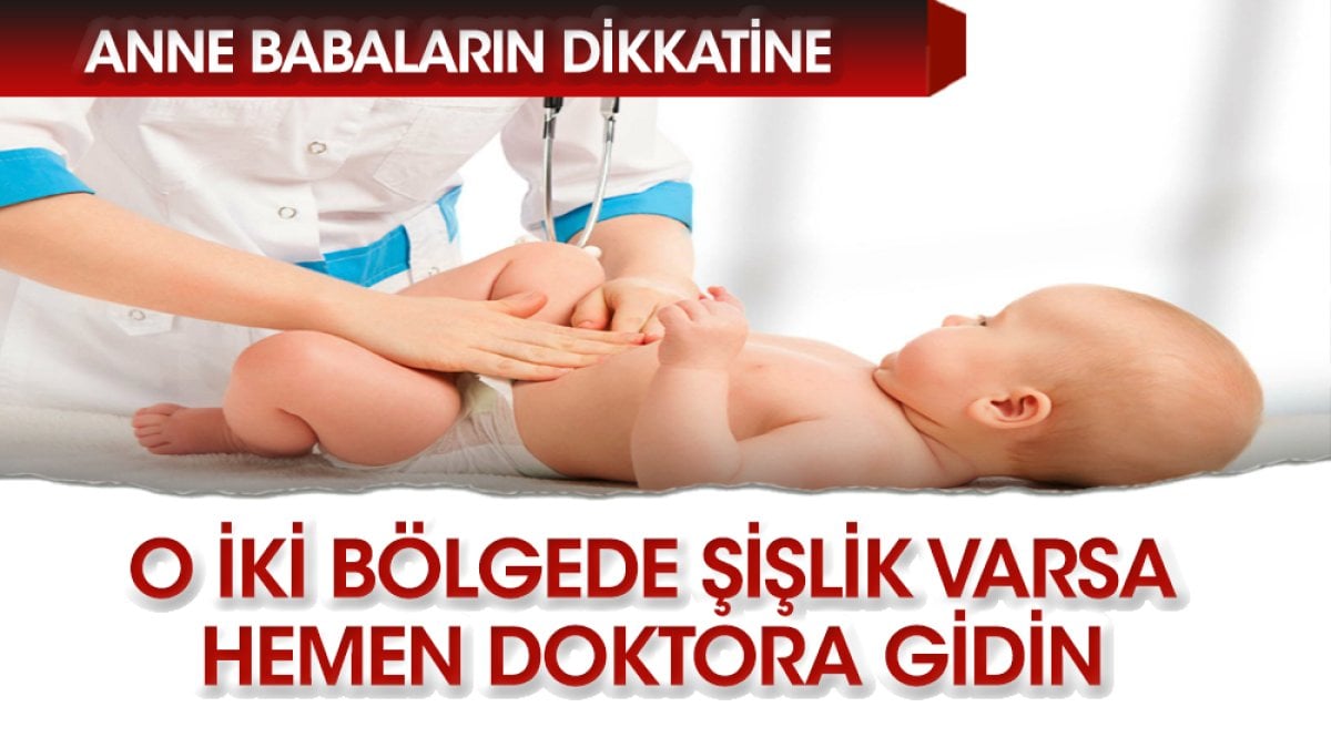 Çocuklarda kasık ve göbek fıtığının nedenleri?