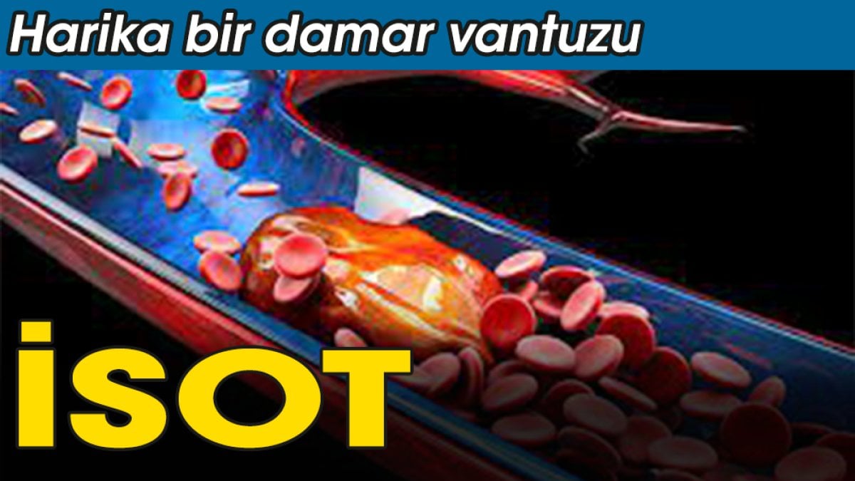 İsot damar vantuzu