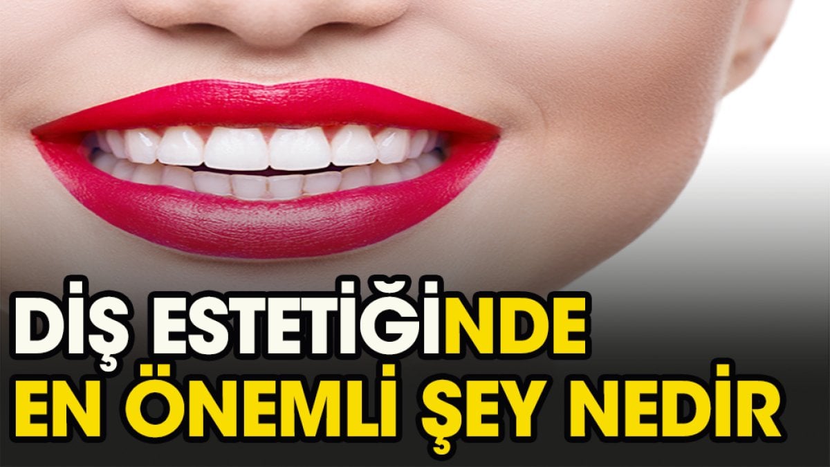 Diş estetiği ne kadar önemlidir