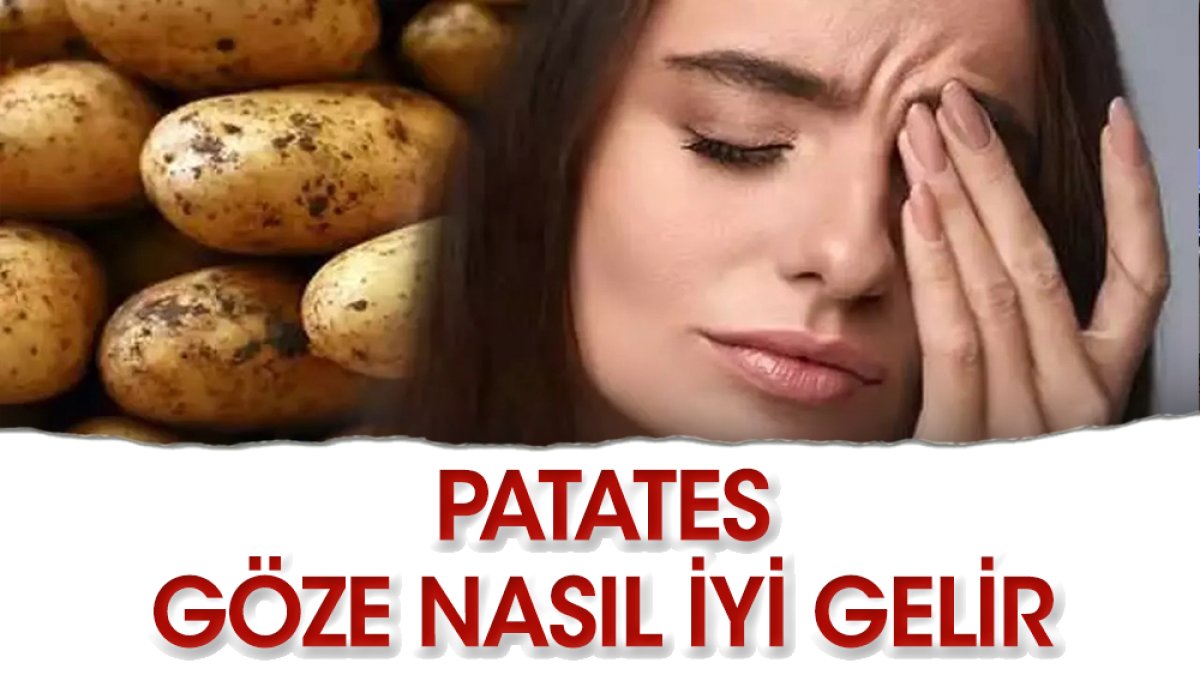 Patates hangi hastalıklara iyi gelir